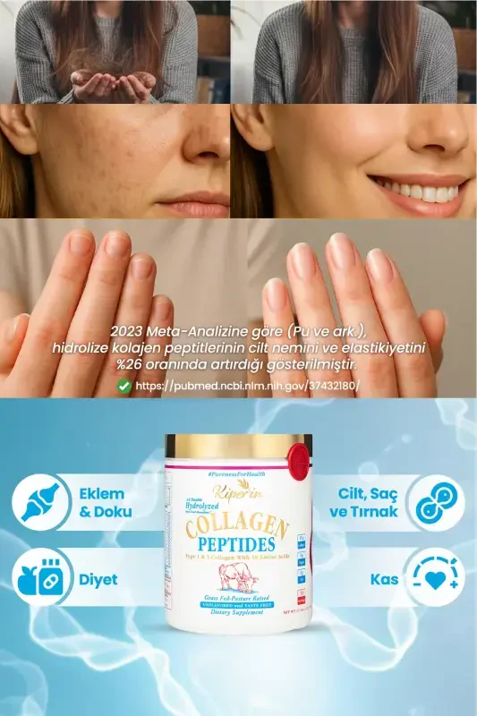 %100 Saf Ve Doğal Yüksek Biyoaktif Çift Hidrolize Kolajen Peptitler içeren Diyet Takviyesi(50günlük) - 3