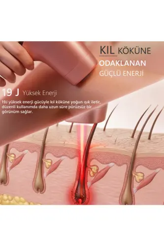 A05 3 Milyon Atım Akıllı Cilt Tanıma Ultra Seri Atım 3 Başlık IPL Lazer Cihazı - Pembe - 8