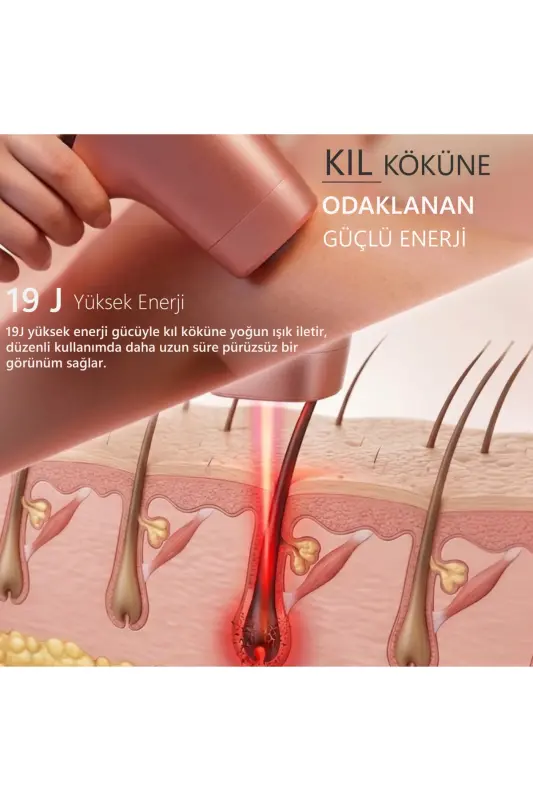 A05 3 Milyon Atım Akıllı Cilt Tanıma Ultra Seri Atım 3 Başlık IPL Lazer Cihazı - Pembe - 8