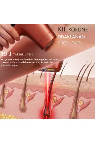 A05 3 Milyon Atım Akıllı Cilt Tanıma Ultra Seri Atım 3 Başlık IPL Lazer Cihazı - Kırmızı - 8