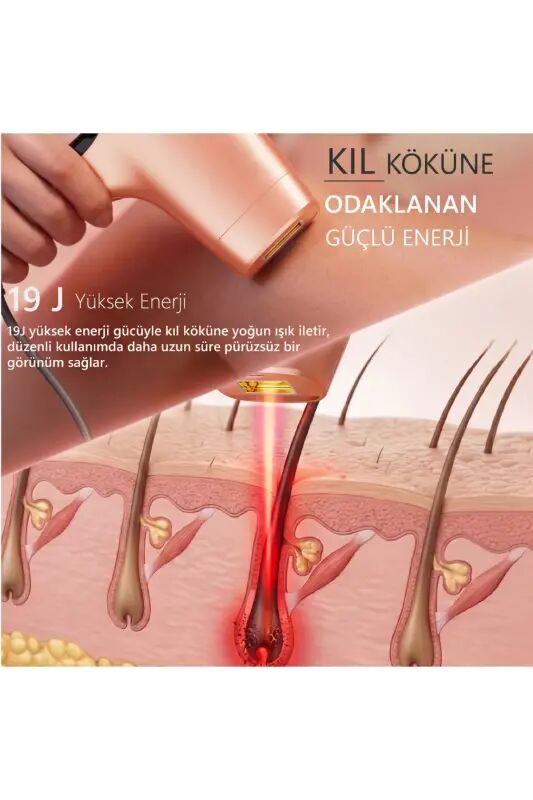 A05 Ipl 3 Million Shots Smart Skin Recognition Ultra Fast Flash 3 Heads Men& Women Device-Orange - 9