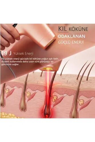 A05 Ipl 3 Миллиона Импульсов Интеллектуальное Распознавание Кожи Ультра Серийная Вспышка 3 Насадки Мужской и Женский Аппарат - Оранжевый - 9