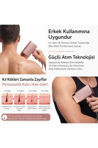 A2024 3 Million Flashes 3 Heads Body-Face-Private Area Unisex Epilation Ultra Series Flashes-Pink - 4