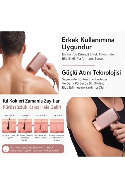 A2024 3 Milyon Atım 3 Başlık Vücut-Yüz-Özel Bölge Bay&bayan Epilasyon Ultra Seri Atım - Pembe - 4