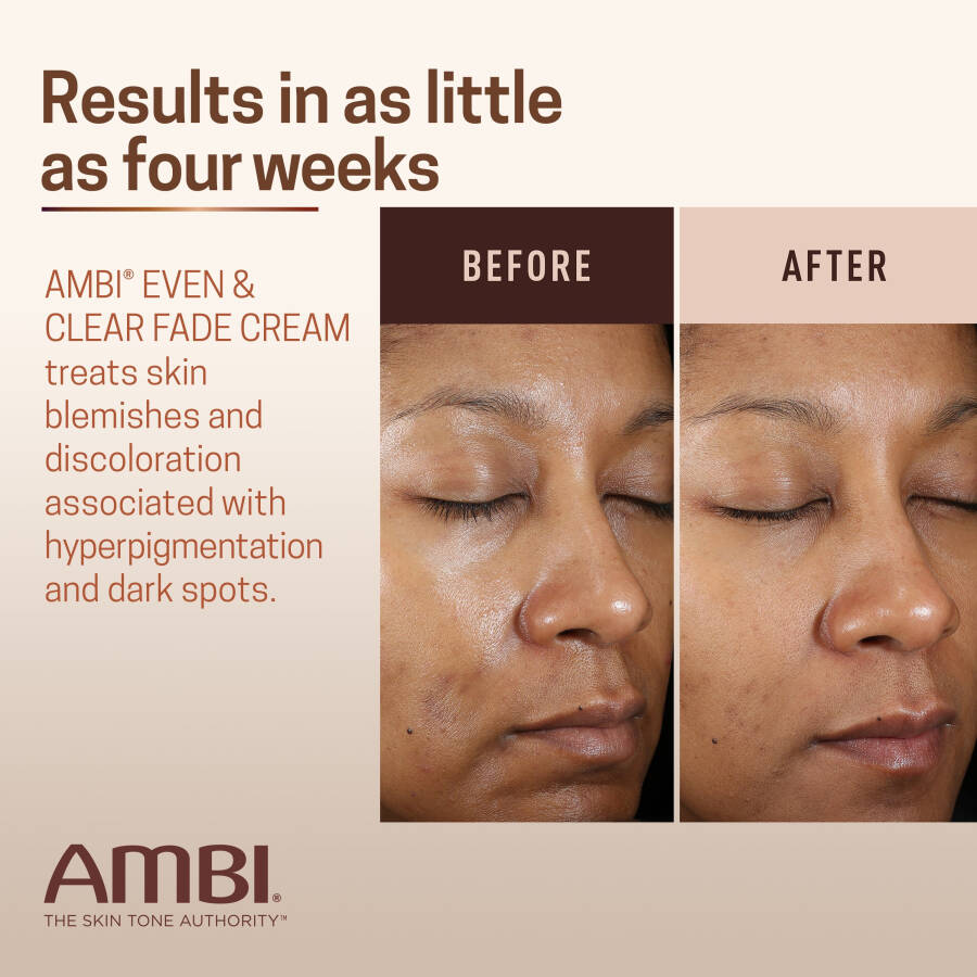 AMBI Even & Clear Facial Fade Cream, Hydroquinone Free, 1 oz - 4