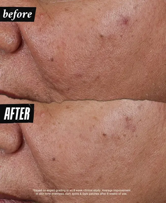 Auto-Tone Discoloration & UV Solution, 1.4 oz.-Us/ca - 8