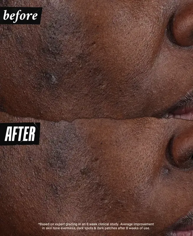 Auto-Tone Discoloration & UV Solution, 1.4 oz.-Us/ca - 9