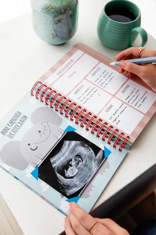 Bebek Anı Ve Anne Hamile Günlüğü Albüm Defter Erkek - MAVİ - 3