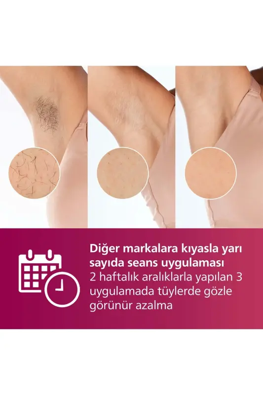 Brı924/00 Lumea Lazer Epilatsiya IPL Soch Olib Tashlash Qurilmasi, Sumka va Yuz Tozalash Qurilmasi Sovg'a Qilingan - 4