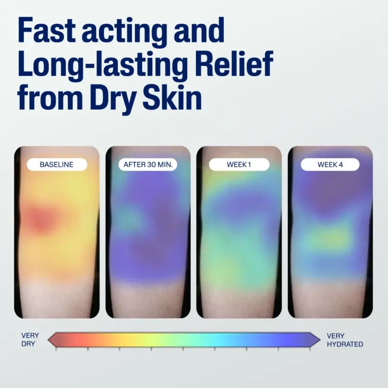 Cetaphil Seyahat hajmidagi, juda quru va quru teriga mo'ljallangan namlovchi krem, hidi yo'q, 3 fl. unts - 12