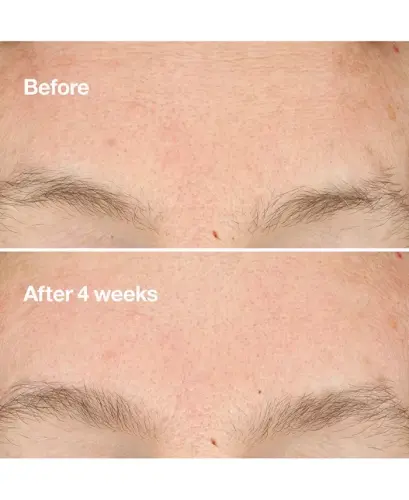 Clarifying Do-Over Peel, 1oz - 4
