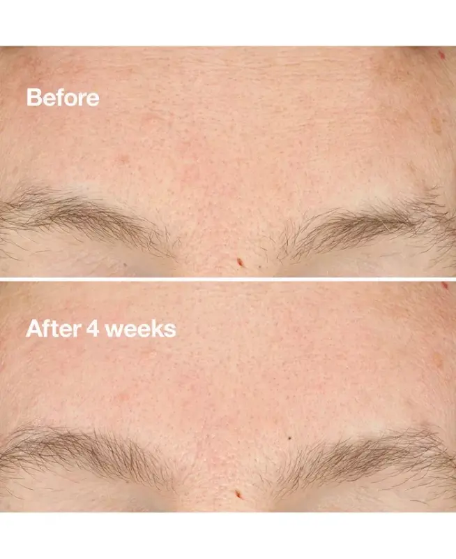 Clarifying Do-Over Peel, 1oz - 4