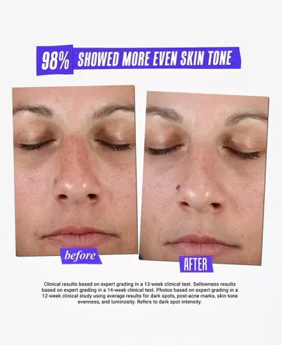Dermatologist Solutions Clearly Corrective Dark Spot Solution, 3.8 oz. - 8