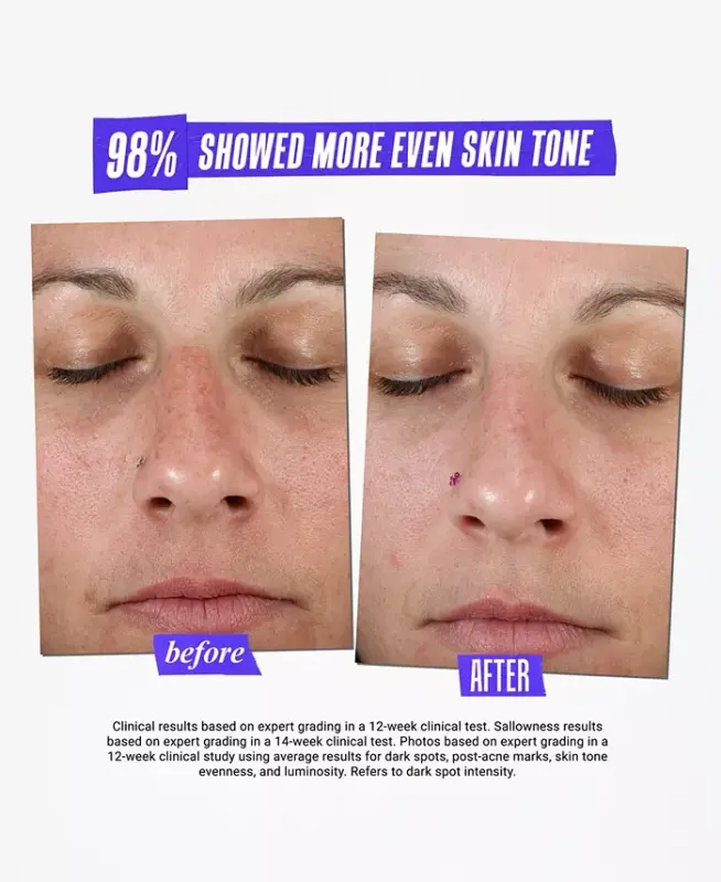Dermatologist Solutions Clearly Corrective Dark Spot Solution, 3.8 oz. - 8