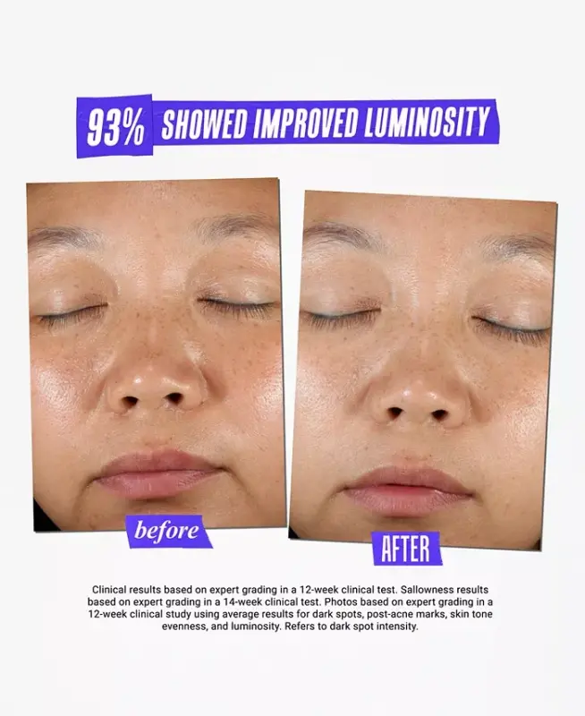 Dermatologist Solutions Clearly Corrective Dark Spot Solution, 3.8 oz. - 9