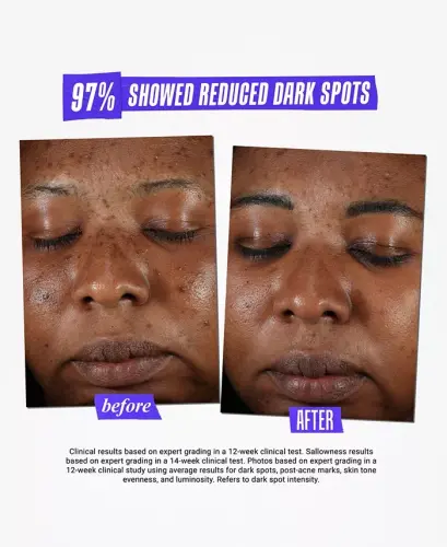 Dermatologist Solutions Clearly Corrective Dark Spot Solution, 3.8 oz. - 10