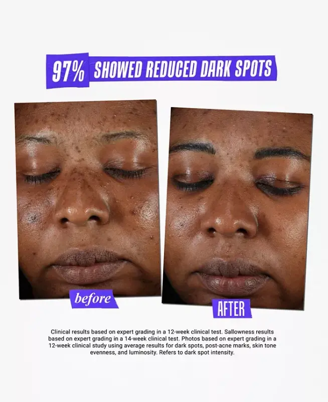Dermatologist Solutions Clearly Corrective Dark Spot Solution, 3.8 oz. - 10