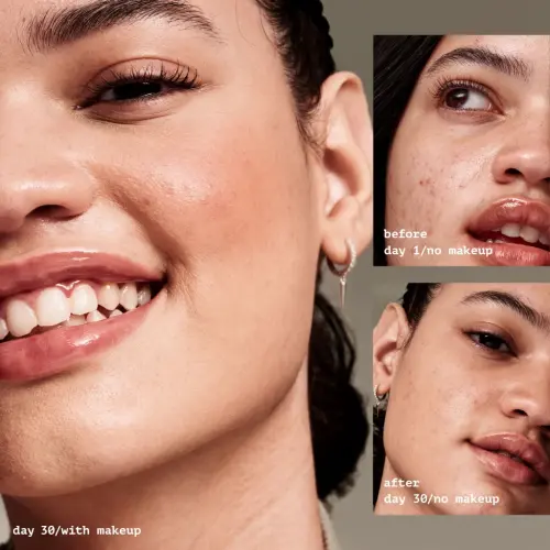 e.l.f. Acne Fighting Putty Primer, 0.74 oz - 3