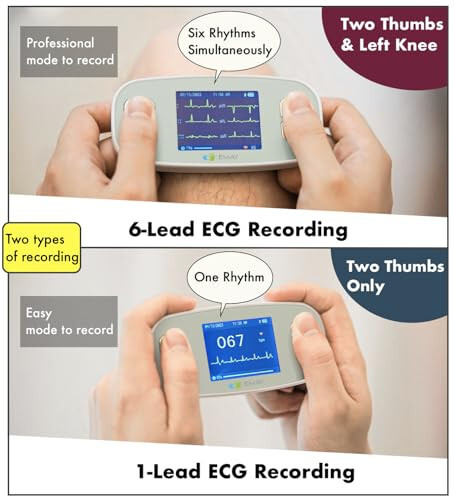 EMAY 6L Ko'chma EKG Monitori | 6 Kanal orqali EKG va Yurak Urishi tezligini yozib olish | Smartfon va Kompyuter bilan mos keladi | Obuna talab qilinmaydi - 5