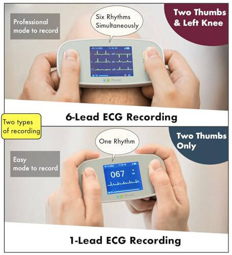 EMAY 6L Ko'chma EKG Monitori | 6 Kanal orqali EKG va Yurak Urishi tezligini yozib olish | Smartfon va Kompyuter bilan mos keladi | Obuna talab qilinmaydi - 5