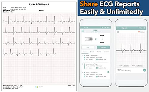 EMAY Portable ECG Monitor | Record ECG and Heart Rate Anytime Anywhere | Stand-alone Device with LCD Screen and Storage | No Subscription Required - 3