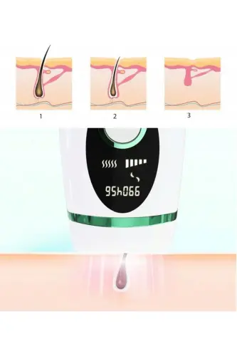 Эпилятор Xiaomi Inface ZH-01D IPL Зеленый - 6