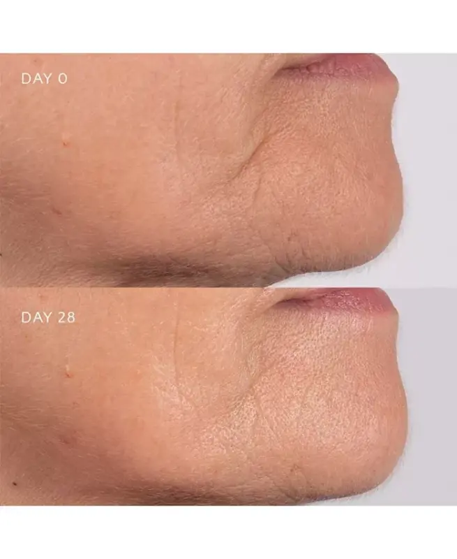 Freedom of Expression - Line Limiter - 15ml - 9