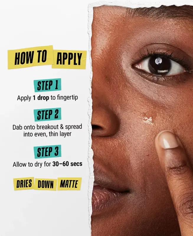 Truly Targeted Acne-Clearing Solution - No Color - 6