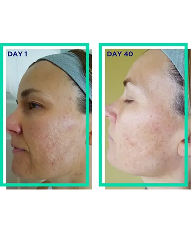 Glow Renewal Serum - 3