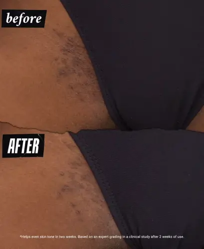 Ingrown Hair & Tone-Correcting Intimate Drops-Personals Ingrown Hair & Tone-correcting Intimate Drops - 2