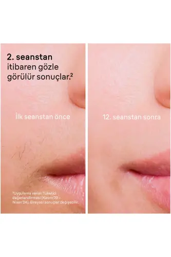 IPL Silk·expert Pro 5, Uyda Soch Olib Tashlash, Sumka, Venus Usturasi, 2 Ta'minot bilan, PL5146 - 4