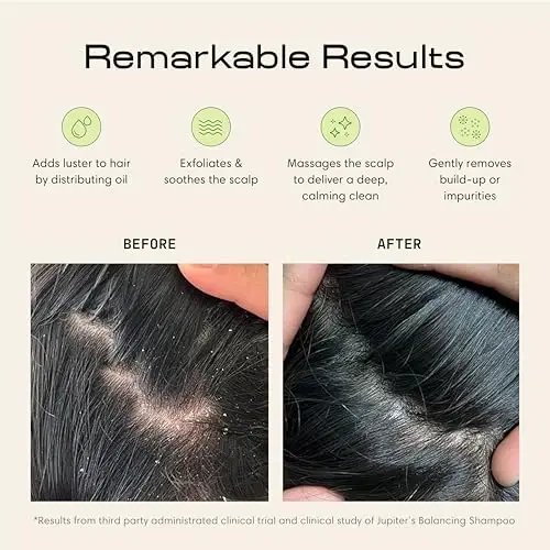 Jupiter Scalp Exfoliator - Scalp Massager Tool for Wet & Dry Hair - Ergonomic Detangler Brush - Dandruff Comb & Scrub to Remove Dandruff & Buildup and Support Circulation - 2 Pack, Black - 3