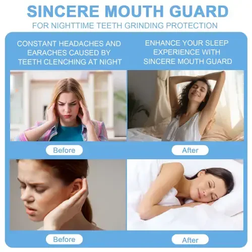 Капа от бруксизма Mitimi, 4 шт., формуемая зубная капа для сна, ночная защита для зубов. - MITIMI (1)