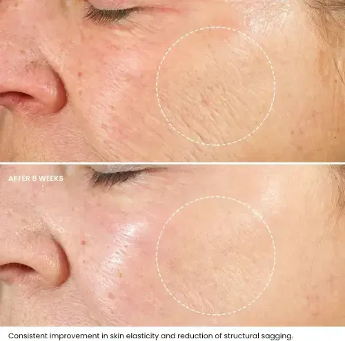 Kleem Organics Retinol Night Cream with Hyaluronic Acid & Collagen- Anti Aging Face Moisturizer to Reduce Wrinkles, Fine Lines, Age Spots -1.7 fl. oz - 4