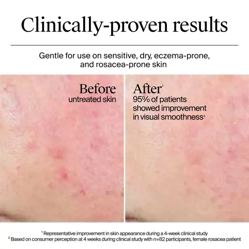 Крем-гель для лица Neutrogena Hydro Boost, с гиалуроновой кислотой, 0,5 жидких унций - 11