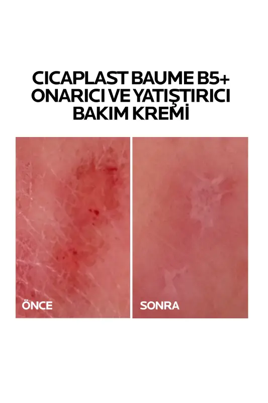 Крем La Roche-Posay Cicaplast Baume B5 40 мл - 7