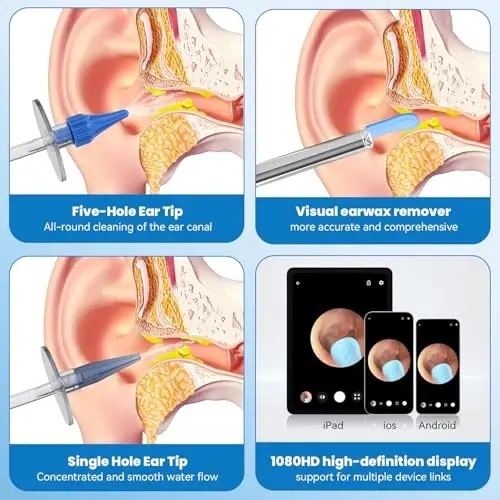 Ear Wax Removal - Ear Cleaner - Ear Camera - Ear Wax Removal Kit - Ear Wax Removal Tool Camera - 1080HD Effective for Cleaning Ear Wax Build-Up - 4