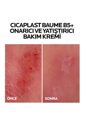 La Roche-Posay Cicaplast Baume B5 Krem 40 ml - 7