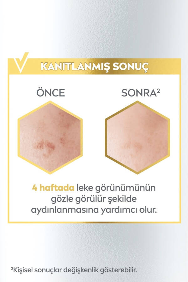 Luminous630 Leke Karşıtı Cilt Bakım Serumu 30ml, Cilt Tonu Eşitleyici, Hyaluronik Asit, E Vitamini - 12