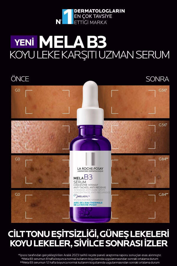 Mela B3 Koyu Leke Karşıtı Serum 30ml - 3