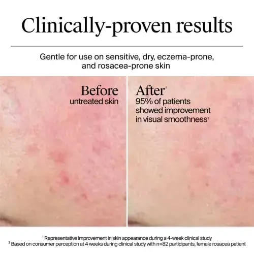 Neutrogena Hydro Boost Hyaluronic Acid Water Cream, 0.5 fl. oz - 11