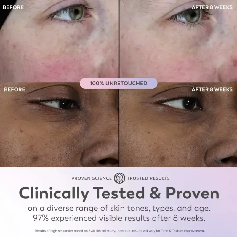 Olay Skin Care Super Serum Facial Serum, 5 в 1, против старения, для всех типов кожи, 1.0 жидких унций - 5