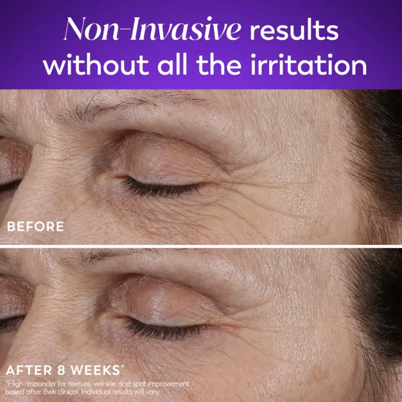 Olay Retinol 24 Max Night Moisturizing Cream with Triple Collagen Peptide, Fragrance-Free, 1.7 fl oz - 8