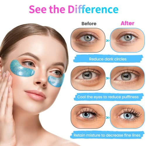 Onespring Under Eye Patches (24 Pairs) - Upgrade Eye Gel Pads for Wrinkles, Puffy Eyes, Dark Circles, Eye Bags, Natural Collagen Eye Gels Pads, Under Eye Mask Patches for Refreshing, Revitalizing - 2