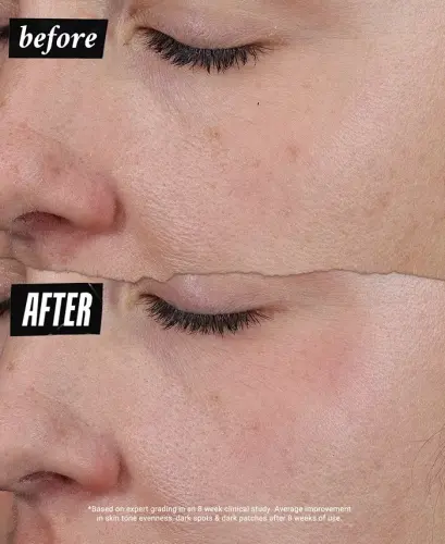 Auto-Tone Discoloration & UV Solution, 1.4 oz.-Us/ca - 3