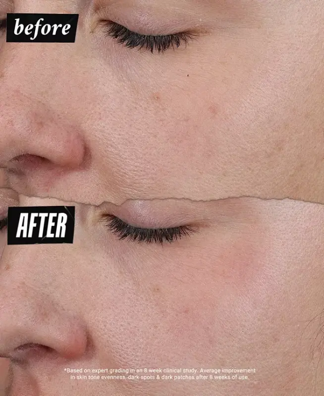 Auto-Tone Discoloration & UV Solution, 1.4 oz.-Us/ca - 3