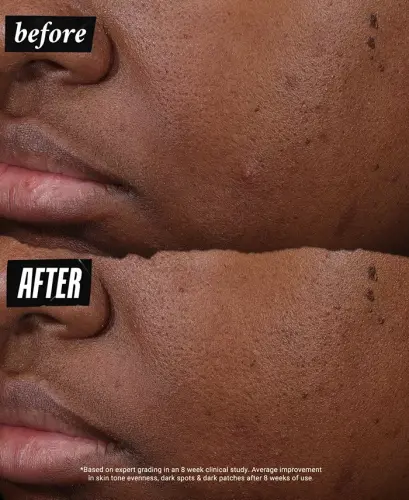 Auto-Tone Discoloration & UV Solution, 1.4 oz.-Us/ca - 10