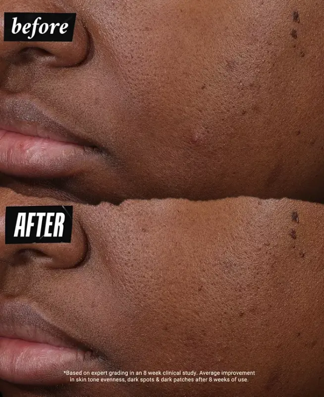 Auto-Tone Discoloration & UV Solution, 1.4 oz.-Us/ca - 10