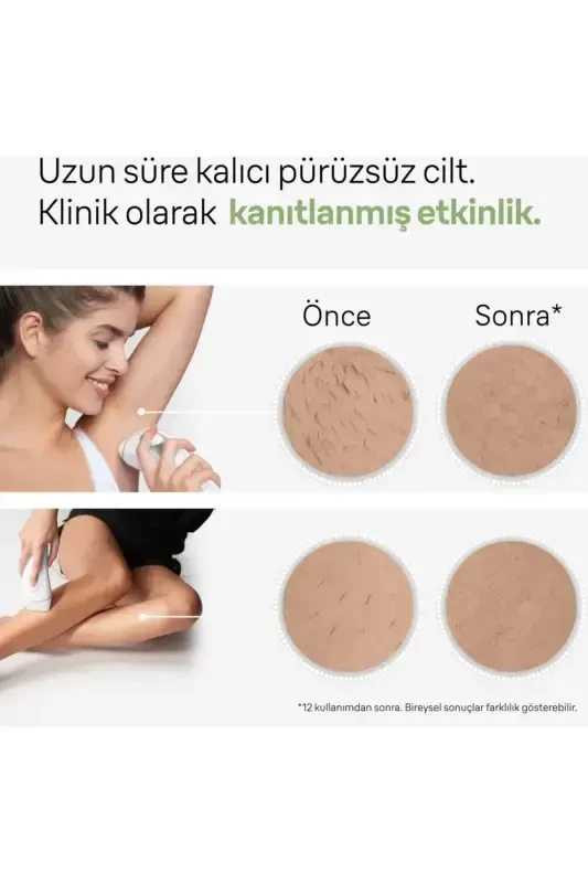 Pl3132 Silk Expert Pro 3 Ipl Лазерный Эпилятор - ФИОЛЕТОВЫЙ - 6