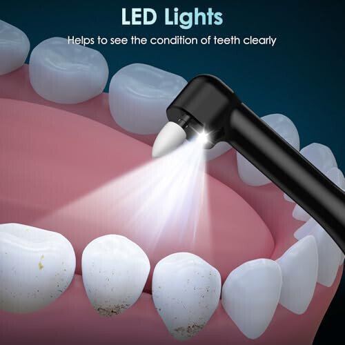 Полировщик для зубов, перезаряжаемый, 5 насадок, 4 режима скорости, для отбеливания и полировки, светодиодная подсветка, 3 пасты, водонепроницаемый IPX6, черный - 4